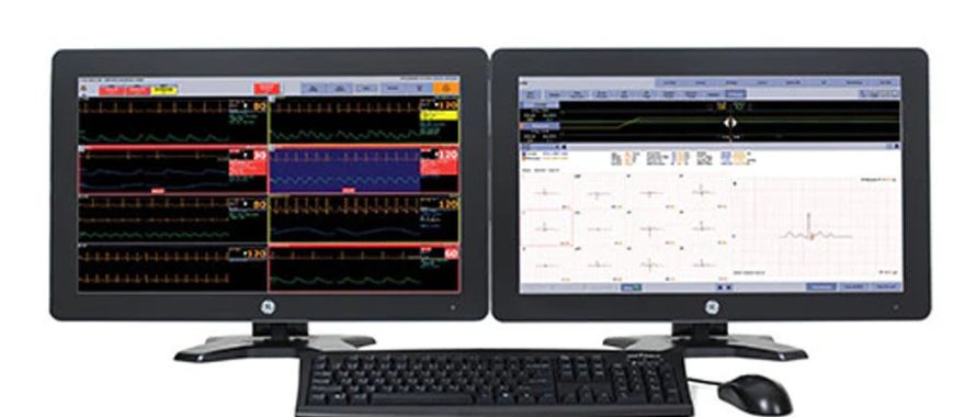 GE ApexPro CH telemetry system